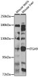 Western blot analysis of extracts of various cell lines, using ITGA9 antibody (STJ110006) at 1:1000 dilution. Secondary antibody: HRP Goat Anti-Rabbit IgG (H+L) (STJS000856) at 1:10000 dilution. Lysates/proteins: 25 Mu g per lane. Blocking buffer: 3% nonfat dry milk in TBST. Detection: ECL Enhanced Kit. Exposure time: 90s.