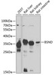 Western blot analysis of extracts of various cell lines, using BSND antibody (STJ110058) at 1:1000 dilution. Secondary antibody: HRP Goat Anti-Rabbit IgG (H+L) (STJS000856) at 1:10000 dilution. Lysates/proteins: 25 Mu g per lane. Blocking buffer: 3% nonfat dry milk in TBST. Detection: ECL Enhanced Kit. Exposure time: 60s.