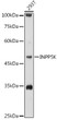 Western blot analysis of lysates from 293T cells, using INPP5K Rabbit polyclonal antibody (STJ110117) at 1:1000 dilution. Secondary antibody: HRP Goat Anti-Rabbit IgG (H+L) (STJS000856) at 1:10000 dilution. Lysates/proteins: 25 Mu g per lane. Blocking buffer: 3% nonfat dry milk in TBST. Detection: ECL Basic Kit. Exposure time: 10s.