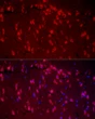 Immunofluorescence analysis of rat brain cells using RBFOX1 rabbit polyclonal antibody (STJ110121) at dilution of 1:50 (40x lens). Blue: DAPI for nuclear staining.