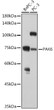 Western blot analysis of various lysates using PAK6 Rabbit polyclonal antibody (STJ110131) at 1:1000 dilution. Secondary antibody: HRP Goat Anti-Rabbit IgG (H+L) (STJS000856) at 1:10000 dilution. Lysates/proteins: 25 Mu g per lane. Blocking buffer: 3% nonfat dry milk in TBST. Detection: ECL Enhanced Kit. Exposure time: 180s.