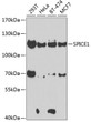 Western blot analysis of various lysates using SPICE1 Rabbit pAb (STJ110165) at 1:1000 dilution. <br/>Secondary antibody: HRP-conjugated Goat anti-Rabbit IgG (H+L) (STJS000856) at 1:10000 dilution. <br/>Lysates/proteins: 25 Mu g per lane. <br/>Blocking buffer: 3% nonfat dry milk in TBST. <br/>Detection: ECL Basic Kit <br/>Exposure time: 90s.
