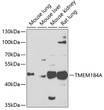 Western blot analysis of various lysates using TMEM184A Rabbit pAb (STJ110167) at 1:1000 dilution. Secondary antibody: HRP-conjugated Goat anti-Rabbit IgG (H+L) (STJS000856) at 1:10000 dilution. Lysates/proteins: 25 Mu g per lane. Blocking buffer: 3% nonfat dry milk in TBST. Detection: ECL Enhanced Kit Exposure time: 90s.