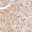 Immunohistochemistry analysis of paraffin-embedded Human pancreas tissue using Proprotein Convertase 9 (PCSK9) Rabbit pAb (STJ110170) at a dilution of 1:200 (40x lens). High pressure antigen retrieval performed with 0. 01M Citrate Bufferr (pH 6. 0) prior to immunohistochemistry staining.