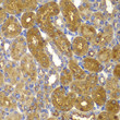 Immunohistochemistry analysis of paraffin-embedded Rat kidney using AMPK Beta 1 Rabbit pAb (STJ110230) at dilution of 1:100 (40x lens). Microwave antigen retrieval performed with 0. 01M PBS Buffer (pH 7. 2) prior to immunohistochemistry staining.
