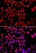 Immunofluorescence analysis of A549 cells using CFL2 Rabbit pAb (STJ110316). Secondary antibody: Cy3-conjugated Goat anti-Rabbit IgG (H+L) (STJS001166) at 1:500 dilution. Blue: DAPI for nuclear staining.