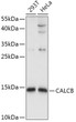 Western blot analysis of various lysates using CALCB Rabbit pAb (STJ110404) at 1:1000 dilution. <br/>Secondary antibody: HRP-conjugated Goat anti-Rabbit IgG (H+L) (STJS000856) at 1:10000 dilution. <br/>Lysates/proteins: 25 Mu g per lane. <br/>Blocking buffer: 3% nonfat dry milk in TBST. <br/>Detection: ECL Basic Kit <br/>Exposure time: 5s.