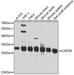 Western blot analysis of various lysates using CAPZB Rabbit pAb (STJ110405) at 1:1000 dilution. <br/>Secondary antibody: HRP-conjugated Goat anti-Rabbit IgG (H+L) (STJS000856) at 1:10000 dilution. <br/>Lysates/proteins: 25 Mu g per lane. <br/>Blocking buffer: 3% nonfat dry milk in TBST. <br/>Detection: ECL Basic Kit <br/>Exposure time: 30s.