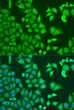Immunofluorescence analysis of U2OS cells using CAPZB Rabbit pAb (STJ110405) at dilution of 1:100. Secondary antibody: Cy3-conjugated Goat anti-Rabbit IgG (H+L) (STJS001166) at 1:500 dilution. Blue: DAPI for nuclear staining.
