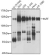Western blot analysis of various lysates using HLTF Rabbit pAb (STJ110651) at 1:1000 dilution. <br/>Secondary antibody: HRP-conjugated Goat anti-Rabbit IgG (H+L) (STJS000856) at 1:10000 dilution. <br/>Lysates/proteins: 25 Mu g per lane. <br/>Blocking buffer: 3% nonfat dry milk in TBST. <br/>Detection: ECL Basic Kit <br/>Exposure time: 5s.