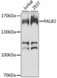 Western blot analysis of various lysates using PALB2 Rabbit pAb (STJ110671) at 1:1000 dilution. <br/>Secondary antibody: HRP-conjugated Goat anti-Rabbit IgG (H+L) (STJS000856) at 1:10000 dilution. <br/>Lysates/proteins: 25 Mu g per lane. <br/>Blocking buffer: 3% nonfat dry milk in TBST. <br/>Detection: ECL Basic Kit <br/>Exposure time: 60s.