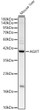 Western blot analysis of lysates from Mouse liver, using AGXT Rabbit pAb (STJ110695) at 1:3000 dilution. <br/>Secondary antibody: HRP-conjugated Goat anti-Rabbit IgG (H+L) (STJS000856) at 1:10000 dilution. <br/>Lysates/proteins: 25 Mu g per lane. <br/>Blocking buffer: 3% nonfat dry milk in TBST. <br/>Detection: ECL Basic Kit <br/>Exposure time: 1s.