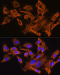 Immunofluorescence analysis of C6 cells using AVPR1A Rabbit pAb (STJ110698) at dilution of 1:100. Secondary antibody: Cy3-conjugated Goat anti-Rabbit IgG (H+L) (STJS001166) at 1:500 dilution. Blue: DAPI for nuclear staining.