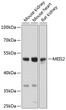 Western blot analysis of various lysates using MEIS2 Rabbit pAb (STJ110735) at 1:1000 dilution. <br/>Secondary antibody: HRP-conjugated Goat anti-Rabbit IgG (H+L) (STJS000856) at 1:10000 dilution. <br/>Lysates/proteins: 25 Mu g per lane. <br/>Blocking buffer: 3% nonfat dry milk in TBST. <br/>Detection: ECL Basic Kit <br/>Exposure time: 10s.