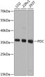 Western blot analysis of various lysates using PDC Rabbit pAb (STJ110745) at 1:1000 dilution. <br/>Secondary antibody: HRP-conjugated Goat anti-Rabbit IgG (H+L) (STJS000856) at 1:10000 dilution. <br/>Lysates/proteins: 25 Mu g per lane. <br/>Blocking buffer: 3% nonfat dry milk in TBST. <br/>Detection: ECL Basic Kit <br/>Exposure time: 10s.
