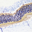 Immunohistochemistry analysis of paraffin-embedded Rat retina using PDC Rabbit pAb (STJ110745) at dilution of 1:200 (40x lens). Microwave antigen retrieval performed with 0. 01M PBS Buffer (pH 7. 2) prior to immunohistochemistry staining.