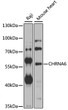 Western blot analysis of various lysates using CHRNA6 Rabbit pAb (STJ110768) at 1:1000 dilution. <br/>Secondary antibody: HRP-conjugated Goat anti-Rabbit IgG (H+L) (STJS000856) at 1:10000 dilution. <br/>Lysates/proteins: 25 Mu g per lane. <br/>Blocking buffer: 3% nonfat dry milk in TBST. <br/>Detection: ECL Basic Kit <br/>Exposure time: 10s.