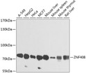 Western blot analysis of various lysates using ZNF408 Rabbit pAb (STJ110810) at 1:1000 dilution. <br/>Secondary antibody: HRP-conjugated Goat anti-Rabbit IgG (H+L) (STJS000856) at 1:10000 dilution. <br/>Lysates/proteins: 25 Mu g per lane. <br/>Blocking buffer: 3% nonfat dry milk in TBST. <br/>Detection: ECL Enhanced Kit <br/>Exposure time: 1s. Western blot analysis of various lysates using ZNF408 Rabbit pAb (STJ110810) at 1:1000 dilution. <br/>Secondary antibody: HRP-conjugated Goat anti-Rabbit IgG (H+L) (STJS000856) at 1:10000 dilution. <br/>Lysates/proteins: 25 Mu g per lane. <br/>Blocking buffer: 3% nonfat dry milk in TBST. <br/>Detection: ECL Enhanced Kit <br/>Exposure time: 1s.