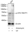 Western blot analysis of lysates from 293T cells, using Phospho-ATF2-T69/T71 Rabbit pAb (STJ110861) at 1:1000 dilution. <br/>Secondary antibody: HRP-conjugated Goat anti-Rabbit IgG (H+L) (STJS000856) at 1:10000 dilution. <br/>Lysates/proteins: 25 Mu g per lane. <br/>Blocking buffer: 3% BSA. <br/>Detection: ECL Basic Kit 