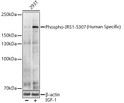 Western blot analysis of various lysates using Phospho-IRS1-S307 (Human Specific) Rabbit pAb (STJ110879) at 1:1000 dilution. 293T cells were treated by IGF-1 (50 ng/ml) at 37 °C for 5 minutes after serum-starvation overnight. <br/>Secondary antibody: HRP-conjugated Goat anti-Rabbit IgG (H+L) (STJS000856) at 1:10000 dilution. <br/>Lysates/proteins: 25 Mu g per lane. <br/>Blocking buffer: 3% nonfat dry milk in TBST. <br/>Detection: ECL Basic Kit <br/>Exposure time: 30s.