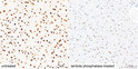 Immunohistochemistry analysis of paraffin-embedded Mouse liver tissue using Phospho-IRS1-S307 (Human Specific) Rabbit pAb (STJ110879) at a dilution of 1:1600 (40x lens). High pressure antigen retrieval performed with 0. 01M Citrate Buffer (pH 6. 0) prior to immunohistochemistry staining.