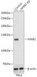 Western blot analysis of lysates from wild type (WT) and NF-Kappa B2 knockout (KO) HeLa cells, using [KO Validated] NF-Kappa B2 Rabbit polyclonal antibody (STJ11100012) at 1:1000 dilution. Secondary antibody: HRP Goat Anti-Rabbit IgG (H+L) (STJS000856) at 1:10000 dilution. Lysates/proteins: 25 Mu g per lane. Blocking buffer: 3% nonfat dry milk in TBST. Detection: ECL Basic Kit. Exposure time: 1min.