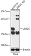 Western blot analysis of lysates from wild type (WT) and UBE2C knockout (KO) HeLa cells, using [KO Validated] UBE2C Rabbit polyclonal antibody (STJ11100048) at 1:1000 dilution. Secondary antibody: HRP Goat Anti-Rabbit IgG (H+L) (STJS000856) at 1:10000 dilution. Lysates/proteins: 25 Mu g per lane. Blocking buffer: 3% nonfat dry milk in TBST. Detection: ECL Basic Kit. Exposure time: 90s.