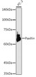 Western blot analysis of lysates from PC-3 cells, using Paxillin Rabbit polyclonal antibody (STJ11100141) at 1:1000 dilution. Secondary antibody: HRP Goat Anti-Rabbit IgG (H+L) (STJS000856) at 1:10000 dilution. Lysates/proteins: 25 Mu g per lane. Blocking buffer: 3% nonfat dry milk in TBST. Detection: ECL Basic Kit. Exposure time: 180s.