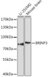 Western blot analysis of various lysates using BRINP3 Rabbit polyclonal antibody (STJ11100194) at 1:1000 dilution. Secondary antibody: HRP Goat Anti-Rabbit IgG (H+L) (STJS000856) at 1:10000 dilution. Lysates/proteins: 25 Mu g per lane. Blocking buffer: 3% nonfat dry milk in TBST. Detection: ECL Basic Kit. Exposure time: 90s.