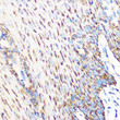 Immunohistochemistry analysis of OSR1 in paraffin-embedded human esophageal using OSR1 Rabbit polyclonal antibody (STJ11100228) at dilution of 1:100 (40x lens). Perform microwave antigen retrieval with 10 mM PBS buffer pH 7. 2 before commencing with immunohistochemistry staining protocol.