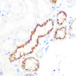 Immunohistochemistry analysis of OSR1 in paraffin-embedded rat kidney using OSR1 Rabbit polyclonal antibody (STJ11100228) at dilution of 1:100 (40x lens). Perform microwave antigen retrieval with 10 mM PBS buffer pH 7. 2 before commencing with immunohistochemistry staining protocol.