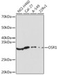 Western blot analysis of various lysates using OSR1 Rabbit polyclonal antibody (STJ11100228) at 1:1000 dilution. Secondary antibody: HRP Goat Anti-Rabbit IgG (H+L) (STJS000856) at 1:10000 dilution. Lysates/proteins: 25 Mu g per lane. Blocking buffer: 3% nonfat dry milk in TBST. Detection: ECL Enhanced Kit. Exposure time: 180s.