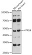 Western blot analysis of various lysates using HTR1B Rabbit polyclonal antibody (STJ11100241) at 1:1000 dilution. Secondary antibody: HRP Goat Anti-Rabbit IgG (H+L) (STJS000856) at 1:10000 dilution. Lysates/proteins: 25 Mu g per lane. Blocking buffer: 3% nonfat dry milk in TBST. Detection: ECL Basic Kit. Exposure time: 90s.
