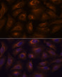 Immunofluorescence analysis of U-2 OS cells using GPR22 antibody (STJ11100269) at dilution of 1:100. Blue: DAPI for nuclear staining.