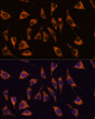 Immunofluorescence analysis of L929 cells using GPR22 antibody (STJ11100269) at dilution of 1:100. Blue: DAPI for nuclear staining.