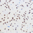 Immunohistochemistry analysis of GTF3C3 in paraffin-embedded Mouse brain using GTF3C3 Rabbit polyclonal antibody (STJ11100359) at dilution of 1:100 (40x lens). Perform microwave antigen retrieval with 10 mM PBS buffer pH 7. 2 before commencing with immunohistochemistry staining protocol.