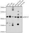 Western blot analysis of various lysates using ZNF557 Rabbit pAb (STJ11100444) at 1:500 dilution. <br/>Secondary antibody: HRP-conjugated Goat anti-Rabbit IgG (H+L) (STJS000856) at 1:10000 dilution. <br/>Lysates/proteins: 25 Mu g per lane. <br/>Blocking buffer: 3% nonfat dry milk in TBST. <br/>Detection: ECL Enhanced Kit <br/>Exposure time: 180s. Western blot analysis of various lysates using ZNF557 Rabbit pAb (STJ11100444) at 1:500 dilution. <br/>Secondary antibody: HRP-conjugated Goat anti-Rabbit IgG (H+L) (STJS000856) at 1:10000 dilution. <br/>Lysates/proteins: 25 Mu g per lane. <br/>Blocking buffer: 3% nonfat dry milk in TBST. <br/>Detection: ECL Enhanced Kit <br/>Exposure time: 180s.