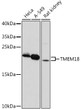 Western blot analysis of various lysates using TMEM18 polyclonal antibody (STJ11100492) at 1:1000 dilution. Secondary antibody: HRP Goat Anti-Rabbit IgG (H+L) (STJS000856) at 1:10000 dilution. Lysates/proteins: 25 Mu g per lane. Blocking buffer: 3% nonfat dry milk in TBST. Detection: ECL Basic Kit. Exposure time: 3min.