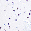 Immunohistochemistry analysis of hnRNP C in paraffin-embedded human brain using hnRNP C Rabbit polyclonal antibody (STJ11100595) at dilution of 1:100 (40x lens). Perform microwave antigen retrieval with 10 mM Tris/EDTA buffer pH 9. 0 before commencing with immunohistochemistry staining protocol.