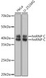 Western blot analysis of various lysates using hnRNP C Rabbit polyclonal antibody (STJ11100595) at 1:1000 dilution. Secondary antibody: HRP Goat Anti-Rabbit IgG (H+L) (STJS000856) at 1:10000 dilution. Lysates/proteins: 25 Mu g per lane. Blocking buffer: 3% nonfat dry milk in TBST. Detection: ECL Basic Kit. Exposure time: 1s.