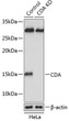 Western blot analysis of lysates from wild type (WT) and CDA knockout (KO) HeLa cells, using [KO Validated] CDA Rabbit polyclonal antibody (STJ11100721) at 1:1000 dilution. Secondary antibody: HRP Goat Anti-Rabbit IgG (H+L) (STJS000856) at 1:10000 dilution. Lysates/proteins: 25 Mu g per lane. Blocking buffer: 3% nonfat dry milk in TBST. Detection: ECL Basic Kit. Exposure time: 5s.