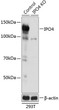 Western blot analysis of lysates from wild type (WT) and IPO4 knockout (KO) 293T cells, using [KO Validated] IPO4 Rabbit polyclonal antibody (STJ11100778) at 1:3000 dilution. Secondary antibody: HRP Goat Anti-Rabbit IgG (H+L) (STJS000856) at 1:10000 dilution. Lysates/proteins: 25 Mu g per lane. Blocking buffer: 3% nonfat dry milk in TBST. Detection: ECL Basic Kit. Exposure time: 1s.