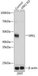 Western blot analysis of lysates from wild type (WT) and VRK1 knockout (KO) 293T cells, using [KO Validated] VRK1 Rabbit polyclonal antibody (STJ11100814) at 1:500 dilution. Secondary antibody: HRP Goat Anti-Rabbit IgG (H+L) (STJS000856) at 1:10000 dilution. Lysates/proteins: 25 Mu g per lane. Blocking buffer: 3% nonfat dry milk in TBST. Detection: ECL Basic Kit. Exposure time: 1s.