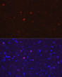 Immunofluorescence analysis of paraffin-embedded rat brain using AIF1/IBA1 Rabbit polyclonal antibody (STJ11100899) at dilution of 1:20 (40x lens). Secondary antibody: Cy3 Goat Anti-Rabbit IgG (H+L) at 1:500 dilution. Blue: DAPI for nuclear staining.