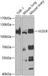 Western blot analysis of extracts of various cell lines, using VLDLR antibody (STJ11100936) at 1:1000 dilution. _Secondary antibody: HRP Goat Anti-Rabbit IgG (H+L) (STJS000856) at 1:10000 dilution. _Lysates/proteins: 25 Mu g per lane. _Blocking buffer: 3% nonfat dry milk in TBST. _Detection: ECL Enhanced Kit. _Exposure time: 90s.