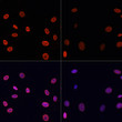 Immunofluorescence analysis of NIH/3T3 cells using Acetyl-Histone H4-K91 Rabbit polyclonal antibody (STJ11100937) at dilution of 1:100. NIH/3T3 cells were treated by TSA (1 uM) at 37 °C for 18 hours. Blue: DAPI for nuclear staining.