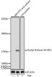 Western blot analysis of lysates from NIH/3T3 cells, using Acetyl-Histone H4-K91 Rabbit polyclonal antibody (STJ11100937) at 1:1000 dilution. NIH/3T3 cells were treated by TSA (1 uM) at 37 °C for 18 hours. Secondary antibody: HRP Goat Anti-Rabbit IgG (H+L) (STJS000856) at 1:10000 dilution. Lysates/proteins: 25 Mu g per lane. Blocking buffer: 3% nonfat dry milk in TBST. Detection: ECL Basic Kit. Exposure time: 300s.