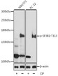 Western blot analysis of various lysates using Phospho-SF3B1-T313 Rabbit pAb (STJ11100985) at 1:1000 dilution. NIH 3T3 cell lysate were treated by CIP (20ul CIP for each 400ul cell lysate) at 37 °C for 1 hour. PC-12 cell lysate were treated by CIP (20ul CIP for each 400ul cell lysate) at 37 °C for 1 hour. <br/>Secondary antibody: HRP-conjugated Goat anti-Rabbit IgG (H+L) (STJS000856) at 1:10000 dilution. <br/>Lysates/proteins: 25 Mu g per lane. <br/>Blocking buffer: 3% BSA. <br/>Detection: ECL Basic Kit <br/>Exposure time: 90s.