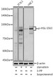 Western blot analysis of lysates from Mouse brown fat using Phospho-HSL-S563 Rabbit pAb (STJ11100992) at 1:5000 dilution incubated overnight at 4 °C. Mouse brown fat were treated by Lambda-PP mixed solution (1 Mu l) at 30 °C for 30 minutes. <br/>Secondary antibody: HRP-conjugated Goat anti-Rabbit IgG (H+L) (STJS000856) at 1:10000 dilution. <br/>Lysates/proteins: 30 Mu g per lane. <br/>Blocking buffer: 3% nonfat dry milk in TBST. <br/>Detection: ECL Basic Kit <br/>Exposure time: 1s.