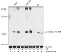 Western blot analysis of various lysates using Phospho-Histone H3-T45 Rabbit pAb (STJ11101034) at 1:1000 dilution. Hela cells, NIH/3T3 cells and C6 cells were treated by CIP (20uL/400ul) at 37 °C for 1 hour or treated by nocodazole (50 ng/mL) at 37 °C for 20 hours. <br/>Secondary antibody: HRP-conjugated Goat anti-Rabbit IgG (H+L) (STJS000856) at 1:10000 dilution. <br/>Lysates/proteins: 25 Mu g per lane. <br/>Blocking buffer: 3% BSA. <br/>Detection: ECL Basic Kit <br/>Exposure time: 60s.